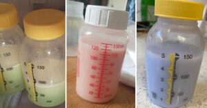 Read more about the article Understanding Breastmilk Colors: What’s Normal and What to Watch For?